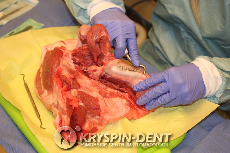 Profesjonalna Asysta w Implantologii - szkolenia dla Dentystów w Gdańsku - Kryspin-Dent