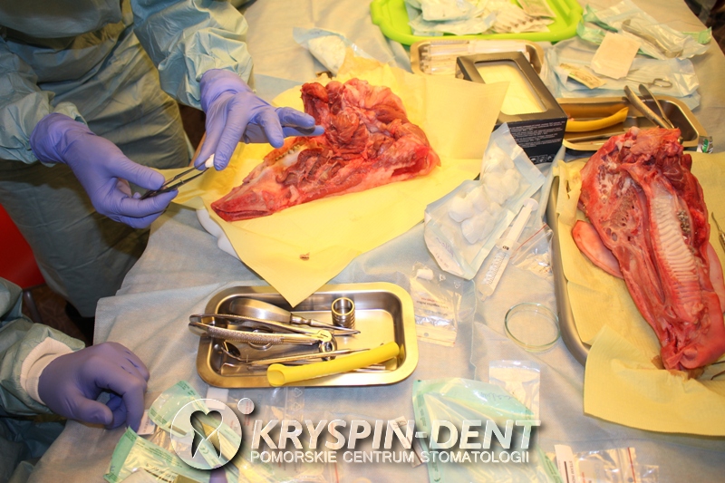 Od ekstrakcji do implantacji - szkolenia dentystyczne w Gdańsku - Kryspin Dent