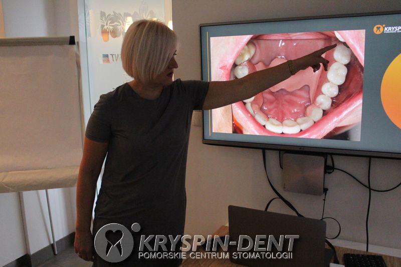 Profesjonalna Asysta w Protetyce - Szkolenia dla Dentystów Gdańsk - Kryspin-Dent
