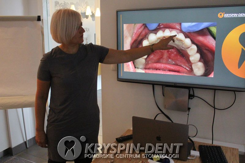 Profesjonalna Asysta w Protetyce - Szkolenia dla Dentystów Gdańsk - Kryspin-Dent